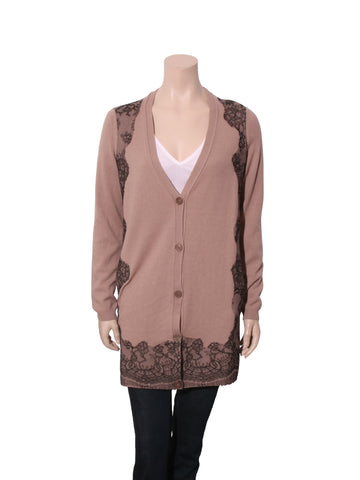 Lace Detail Cardigan